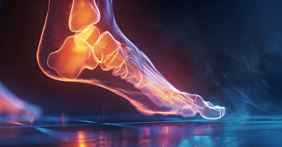 An illustrated foot with bright spots highlighting heel pain